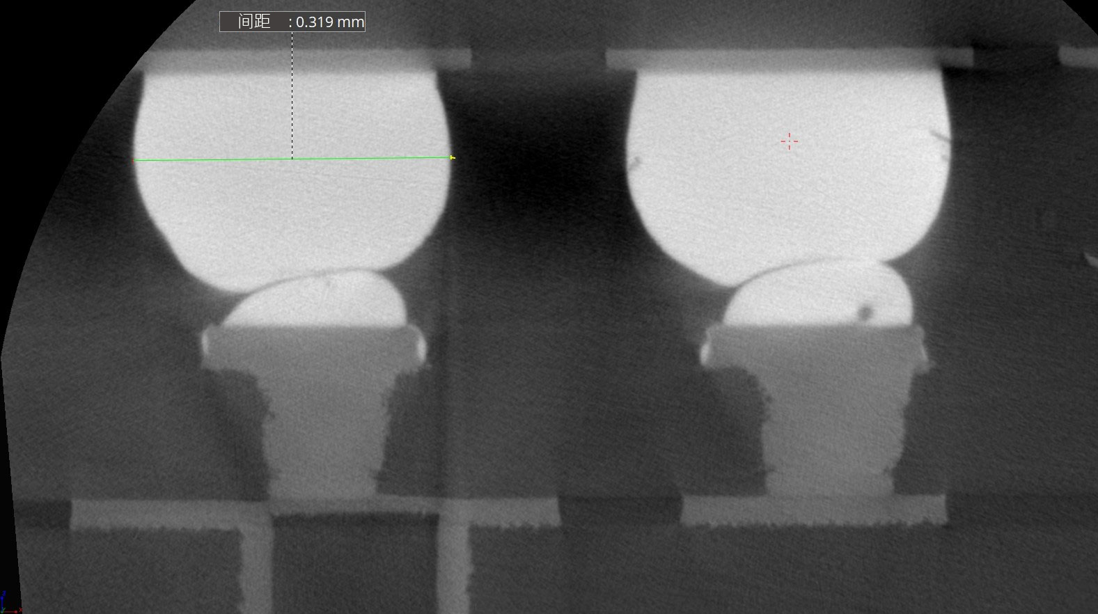 焊点检测间距-直径-xray