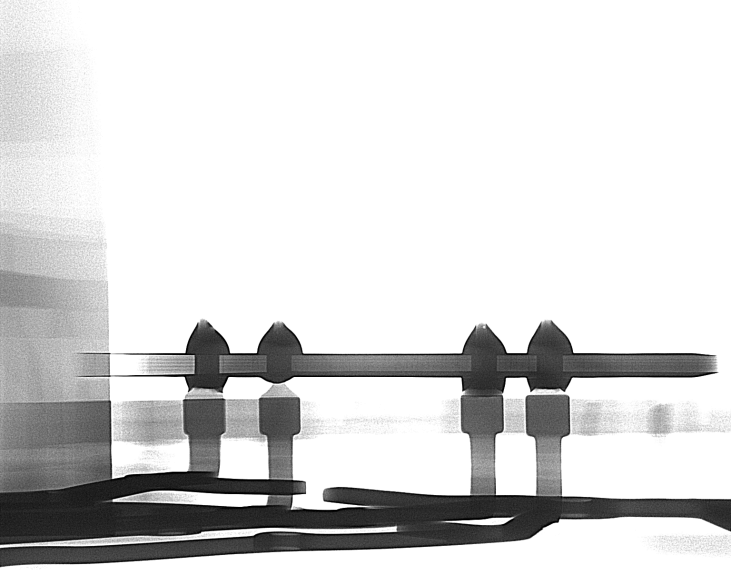 车用零部件-线路板插件注塑件x射线图