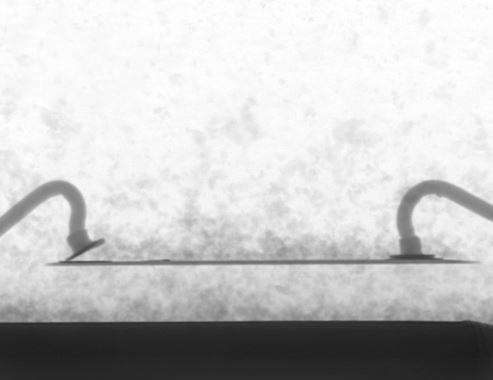 X-RAY检测芯片键合线