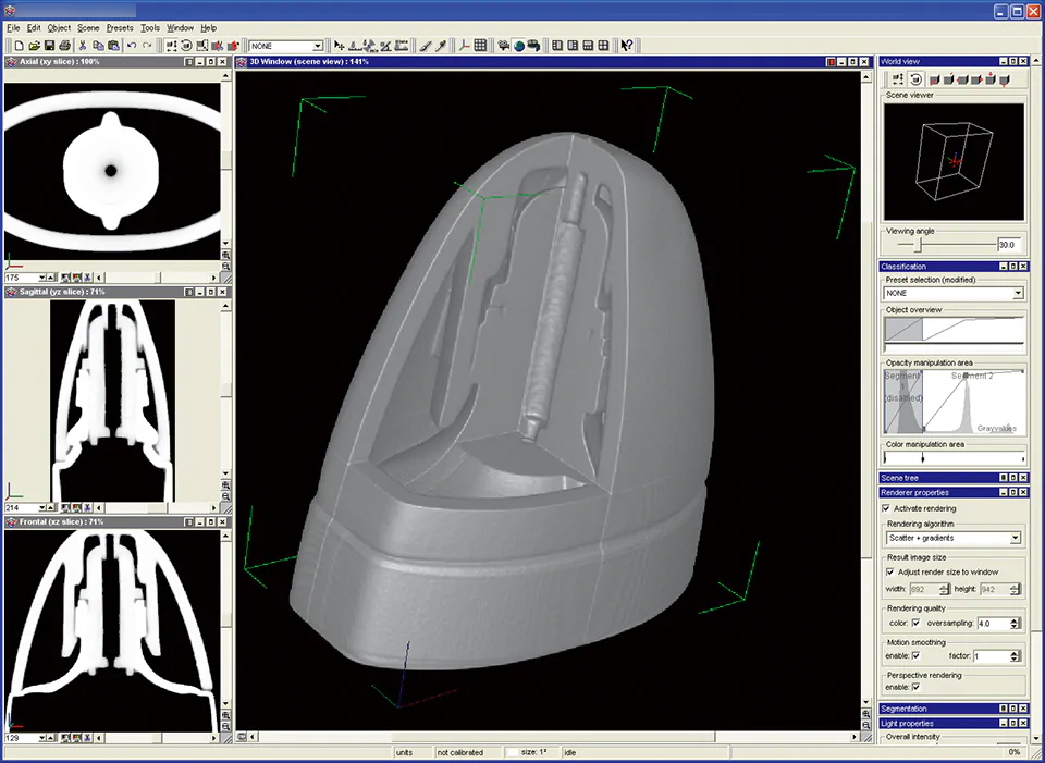 CT断层扫描样图