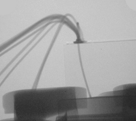 引线键合线检测